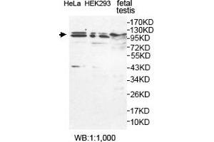 Western blot analysis of feteal testis, HeLa and HEK293 cell lysates, using USP29 antibody. (USP29 Antikörper  (AA 15-215))