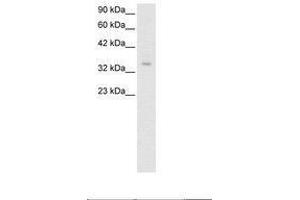 Image no. 2 for anti-Zinc Finger Protein 391 (ZNF391) (AA 66-115) antibody (ABIN6735795) (ZNF391 Antikörper  (AA 66-115))