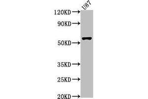 Western Blot Positive WB detected in: U87 whole cell lysate All lanes: RORB antibody at 1:1000 Secondary Goat polyclonal to rabbit IgG at 1/50000 dilution Predicted band size: 54, 53 kDa Observed band size: 54 kDa (RORB Antikörper  (AA 1-269))