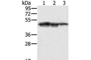 Western Blot analysis of Hepg2, K562 and Jurkat cell using SMARCB1 Polyclonal Antibody at dilution of 1:400 (SMARCB1 Antikörper)