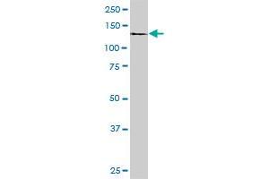 DDEF1 monoclonal antibody (M02), clone 1B5. (ASAP1 Antikörper  (AA 1030-1129))
