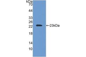 Western blot analysis of recombinant Mouse SOD2. (SOD2 Antikörper  (AA 25-222))