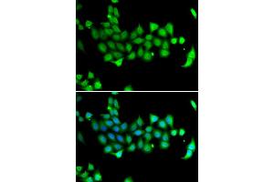 Immunofluorescence analysis of A549 cell using HSPA14 antibody. (HSPA14 Antikörper)