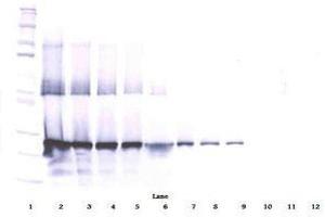 Image no. 3 for anti-WNT1 Inducible Signaling Pathway Protein 2 (WISP2) antibody (ABIN465385) (WISP2 Antikörper)
