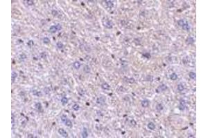 Immunohistochemistry of F1Aα in mouse liver tissue with F1Aalpha antibody at 5 μg/ml. (FEM1B Antikörper  (C-Term))