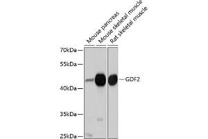 Western blot analysis of extracts of various cell lines, using GDF2 antibody (ABIN6127500, ABIN6141041, ABIN6141042 and ABIN6214818) at 1:1000 dilution. (GDF2 Antikörper  (AA 320-429))