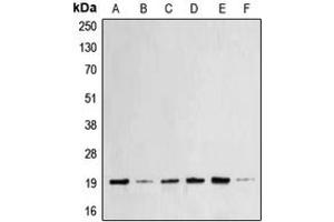 Western blot analysis of BAX expression in MCF7 (A), HeLa (B), A431 (C), HEK293T (D), Raw264. (BAX Antikörper  (N-Term))