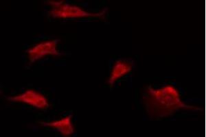 ABIN6274598 staining Hela by IF/ICC. (LI Cadherin Antikörper  (Internal Region))