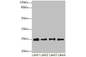 Western blot All lanes: RPS8 antibody at 6 μg/mL Lane 1: HL60 whole cell lysate Lane 2: THP-1 whole cell lysate Lane 3: 293T whole cell lysate Lane 4: Mouse liver tissue Secondary Goat polyclonal to rabbit IgG at 1/10000 dilution Predicted band size: 25 kDa Observed band size: 25 kDa (RPS8 Antikörper  (AA 2-208))