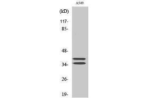 Western Blotting (WB) image for anti-Linker For Activation of T Cells (LAT) (Tyr660) antibody (ABIN3185362) (LAT Antikörper  (Tyr660))