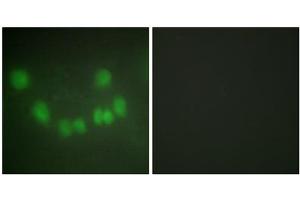 Immunofluorescence analysis of HUVEC cells, using CDC2 antibody. (CDK1 Antikörper  (Internal Region))