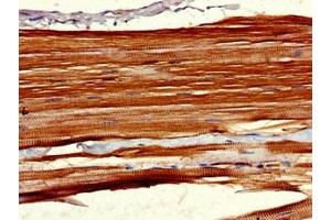 Immunohistochemistry of paraffin-embedded human skeletal muscle tissue using ABIN7158320 at dilution of 1:100