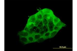 Immunofluorescence (IF) image for anti-LIM Domain Binding 3 (LDB3) (AA 1-283) antibody (ABIN524582)