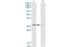Western Blot analysis of TGIF2 expression in transfected 293T cell line by TGIF2 monoclonal antibody (M16A), clone 2D4. (TGIF2 Antikörper  (AA 1-237))
