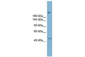 RBBP6 antibody used at 1 ug/ml to detect target protein.