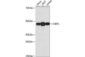 Western blot analysis of extracts of various cell lines, using CtBP1 Rabbit mAb (ABIN7265976) at 1:1000 dilution. (CTBP1 Antikörper)