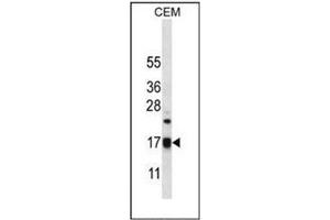 Western blot analysis of MRPS12 in CEM cell line lysates (35ug/lane). (MRPS12 Antikörper  (Middle Region))