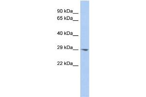WB Suggested Anti-ECHDC2 Antibody Titration:  0. (ECHDC2 Antikörper  (Middle Region))
