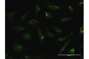 Immunofluorescence of purified MaxPab antibody to FTL on HeLa cell. (FTL Antikörper  (AA 1-175))
