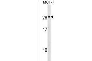 NKAI4 Antibody (C-term) (ABIN1536774 and ABIN2849663) western blot analysis in MCF-7 cell line lysates (35 μg/lane). (NKAIN4 Antikörper  (C-Term))