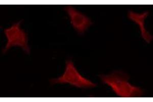 ABIN6266609 staining HeLa by IF/ICC. (CDKN2B Antikörper  (Internal Region))