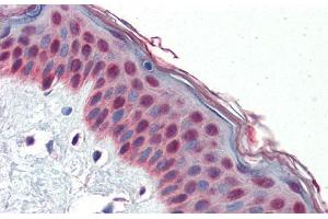 Human Skin; Immunohistochemistry with Human Skin lysate tissue at an antibody concentration of 5. (TCF7L1 Antikörper  (N-Term))