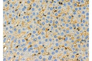 ABIN6257071 and ABIN6274969 at 1/100 staining Rat liver tissue by IHC-P. (CPE Antikörper  (Internal Region))