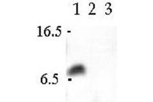 Western Blot analsyis using Cellubrevin antibody in Human CaCo-2 cell extract (Lane 1), Canine MDCK cell extract (Lane 2) and Rat PC12 cell extract. (VAMP3 Antikörper  (N-Term))