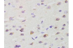 Formalin-fixed and paraffin embedded rat brain labeled with Anti-GALR2 Polyclonal Antibody, Unconjugated (ABIN1386167) at 1:200 followed by conjugation to the secondary antibody and DAB staining (GALR2 Antikörper  (AA 51-150))
