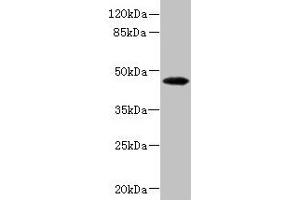Western blot All lanes: PHKG2 antibody at 3.