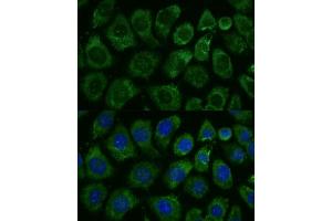 Immunofluorescence (IF) image for anti-Mitogen-Activated Protein Kinase Kinase Kinase 1 (MAP3K1) (C-Term) antibody (ABIN7268647)