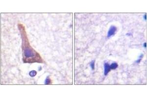 Immunohistochemistry (IHC) image for anti-Adrenergic, beta-2-, Receptor, Surface (ADRB2) (AA 321-370), (pSer346) antibody (ABIN1531704)
