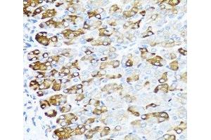 Immunohistochemistry of paraffin-embedded Mouse stomach using MGP Polyclonal Antibody at dilution of 1:100 (40x lens). (MGP Antikörper)
