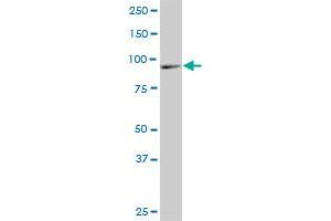 DNAJC10 monoclonal antibody (M02A), clone 3A8. (DNAJC10 Antikörper  (AA 688-793))