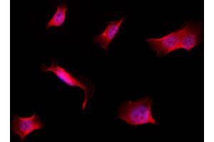 ABIN6257584 and ABIN6274265 staining Hela by IF/ICC. (CK1 epsilon Antikörper  (Internal Region))