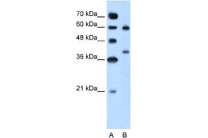 WB Suggested Anti-ARG1 Antibody Titration:  5. (Liver Arginase Antikörper  (N-Term))