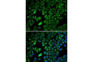 Immunofluorescence analysis of U2OS cell using PRMT5 antibody. (PRMT5 Antikörper)