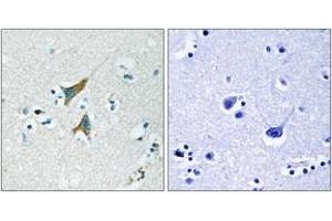 Immunohistochemistry (IHC) image for anti-Dual Specificity Phosphatase 1 (DUSP1) (AA 318-367) antibody (ABIN2888897) (DUSP1 Antikörper  (AA 318-367))