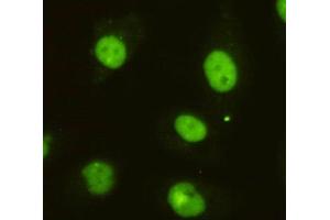 Immunocytochemistry of HeLa cells using anti-DBC1 mouse mAb diluted 1:200. (DBC1 Antikörper)