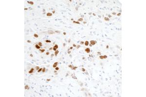 Immunohistochemistry (IHC) image for anti-Tumor Protein P53 (TP53) (AA 20-25) antibody (ABIN7455068)