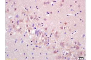 Formalin-fixed and paraffin embedded rat brain labeled with Anti-LIMK1 Polyclonal Antibody, Unconjugated (ABIN680518) at 1:200 followed by conjugation to the secondary antibody and DAB staining. (LIM Domain Kinase 1 Antikörper  (AA 451-550))