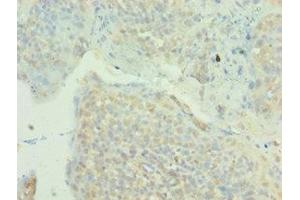 Immunohistochemistry of paraffin-embedded human tonsil tissue using ABIN7160003 at dilution of 1:100 (MAPK4 Antikörper  (AA 348-587))