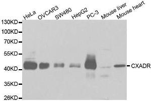 Western blot analysis of extracts of various cell lines, using CXADR antibody. (Coxsackie Adenovirus Receptor Antikörper  (AA 20-237))