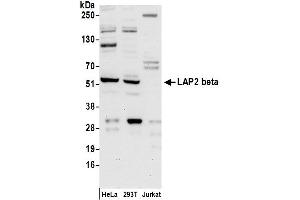 Western Blotting (WB) image for anti-LAP2 beta/tmpo (AA 300-350) antibody (ABIN7455056) (LAP2 beta/tmpo (AA 300-350) Antikörper)