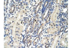 EIF4E2 antibody was used for immunohistochemistry at a concentration of 4-8 ug/ml to stain Epithelial cells of renal tubule (arrows) in Human Kidney. (EIF4E2 Antikörper  (N-Term))