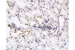 Immunohistochemistry (Paraffin-embedded Sections) (IHC (p)) image for anti-Hepatocyte Growth Factor (Hepapoietin A, Scatter Factor) (HGF) (AA 201-300) antibody (ABIN736551)