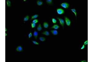 Immunofluorescence staining of A549 cells with ABIN7151424 at 1:166, counter-stained with DAPI. (EFHD1 Antikörper  (AA 15-72))