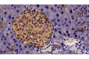 Detection of CBX3 in Mouse Pancreas Tissue using Polyclonal Antibody to Chromobox Homolog 3 (CBX3) (CBX3 Antikörper  (AA 1-183))