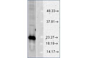 Image no. 2 for anti-Superoxide Dismutase 1, Soluble (SOD1) antibody (ABIN264856) (SOD1 Antikörper)