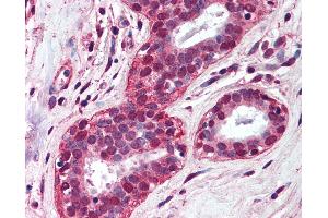 Anti-TLR4 antibody IHC of human breast. (TLR4 Antikörper  (AA 100-200))